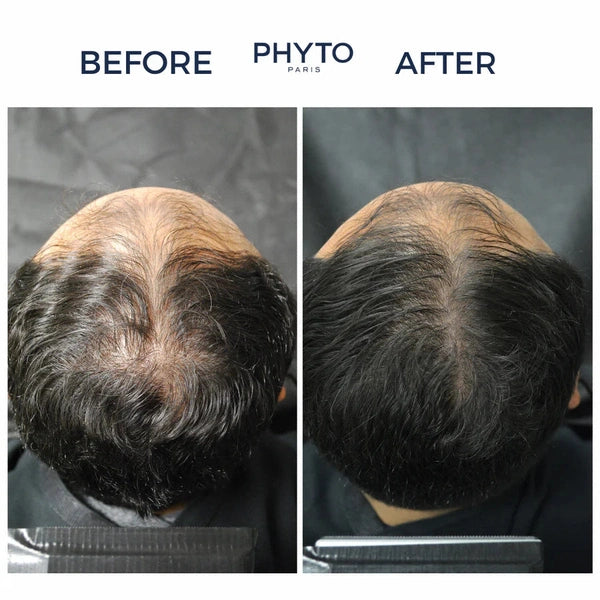 Phyto Phytocyane - Men Densifying Hair Serum